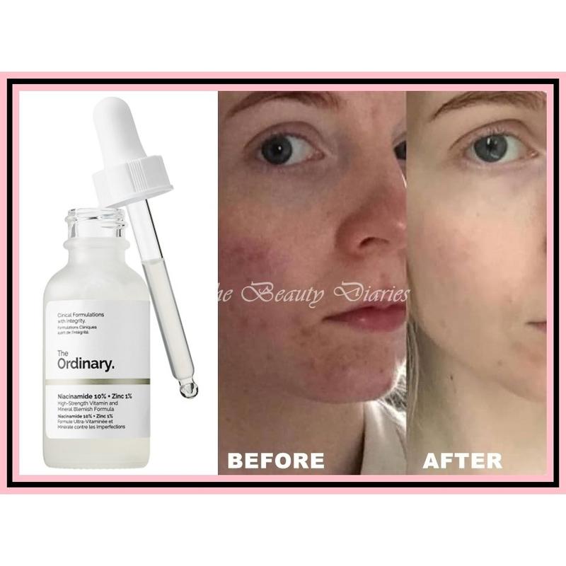 Сыворотка для идеальной кожи the ordinary niacinamide 10% + zinc 1% ...